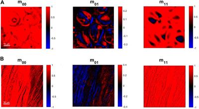 Polarization Label-Free Microscopy Imaging of Biological Samples by Exploiting the Zeeman Laser Emission